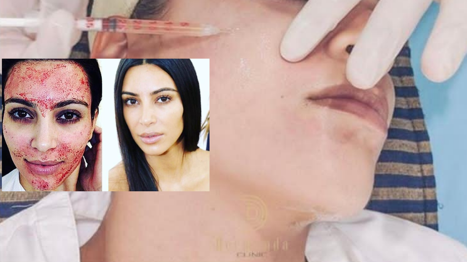  Dermand Clinic تقدم تقنية الـPRP بجودة عالية واهتمامٍ لا مثيل له - صورة مميزة صورة مميزة: Dermand Clinic تقدم تقنية الـPRP بجودة عالية واهتمامٍ لا مثيل له
