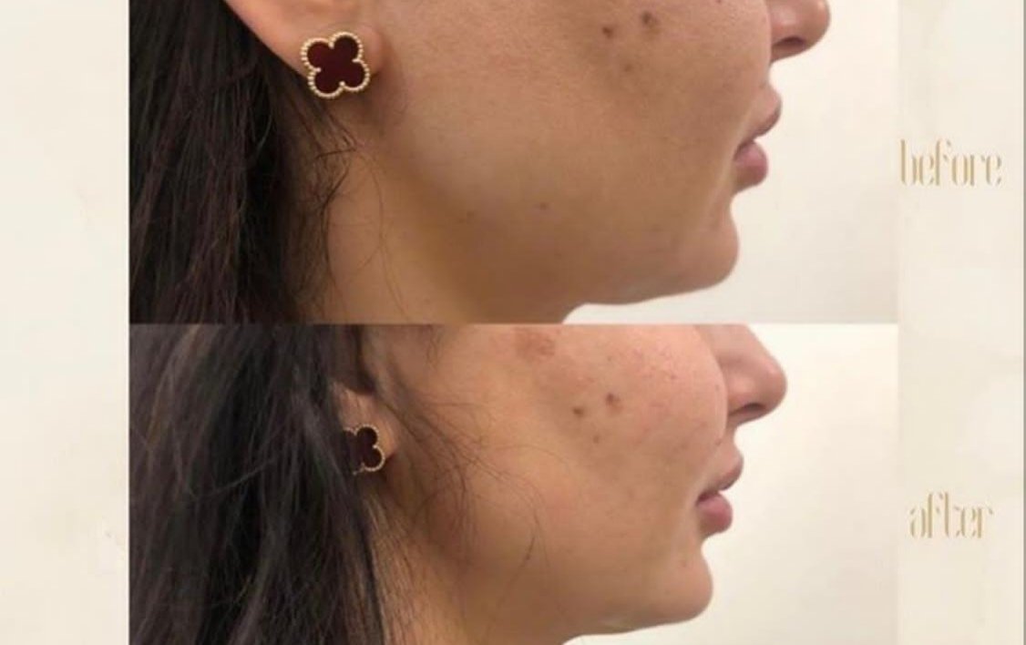 صورة مميزة: مركز Dermanda Clinic التجميلي ريادة في تقديم العلاجات الآمنة للمشاكل الجلدية