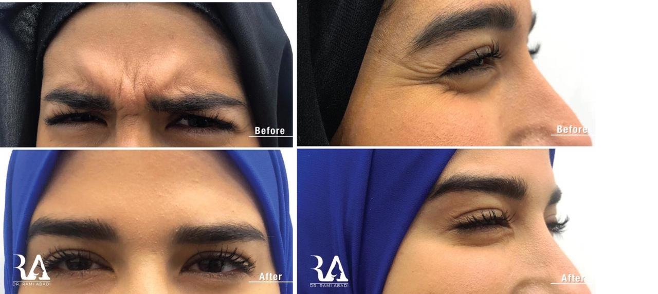 حوار مع دكتور الأمراض الجلديَّة والتّجميل رامي عبادي - صورة مميزة صورة مميزة: حوار مع دكتور الأمراض الجلديَّة والتّجميل رامي عبادي