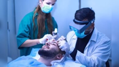 صورة توضيحية - Tito center يحقق النجاح على مستوى زراعة الشعر