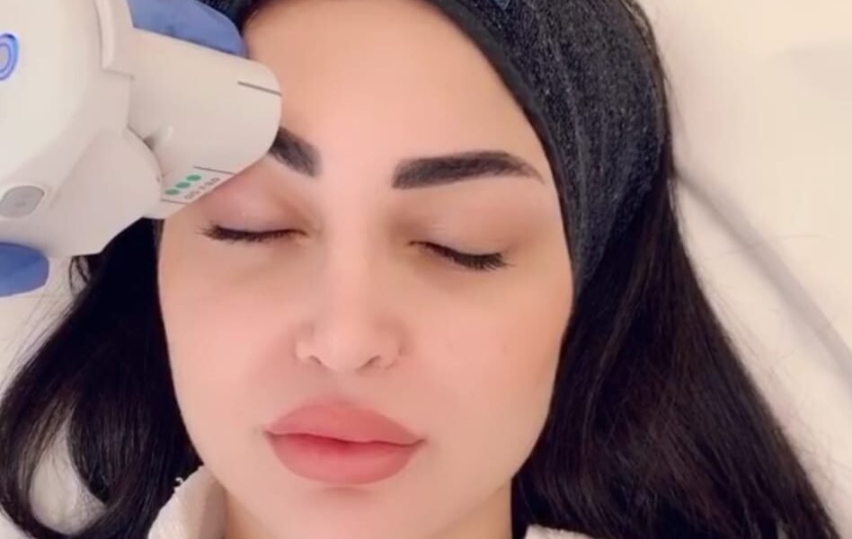تعرفي على تقنية Ultherapy مع الدكتور رامي عبادي