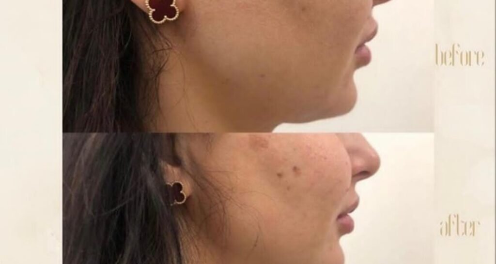 مركز Dermanda Clinic التجميلي ريادة في تقديم العلاجات الآمنة للمشاكل الجلدية